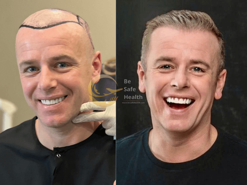 Case 1 - Before & After