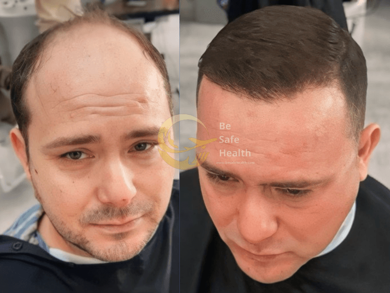 Case 2 - Before & After