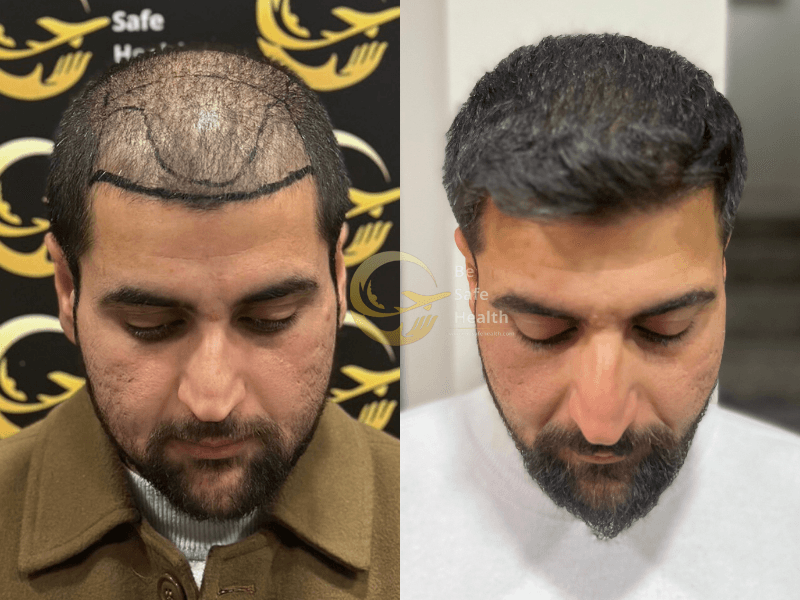 Case 3 - Before & After