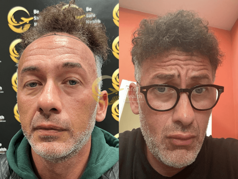 Case 4 - Before & After