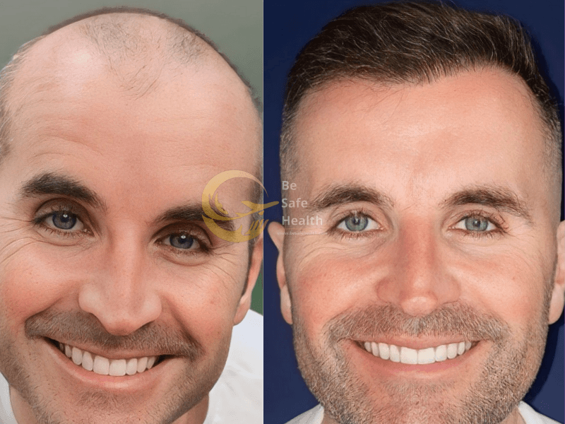 Case 5 - Before & After