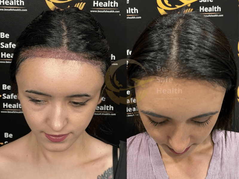 Case 6 - Before & After