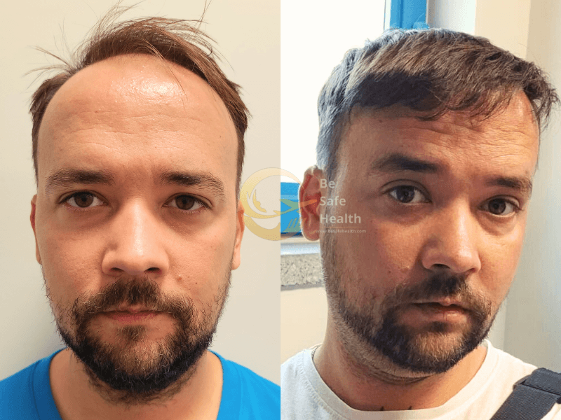 Case 8 - Before & After