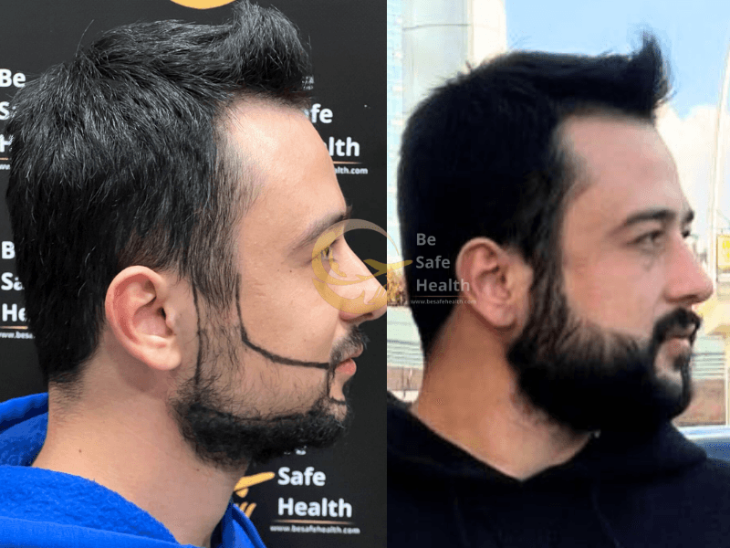 Case 9 - Before & After